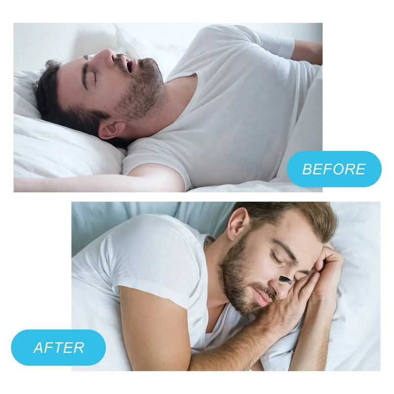 Anti-Snoring Magnetic Nose Clip Kit - Boost Airflow for Better Sleep & Performance